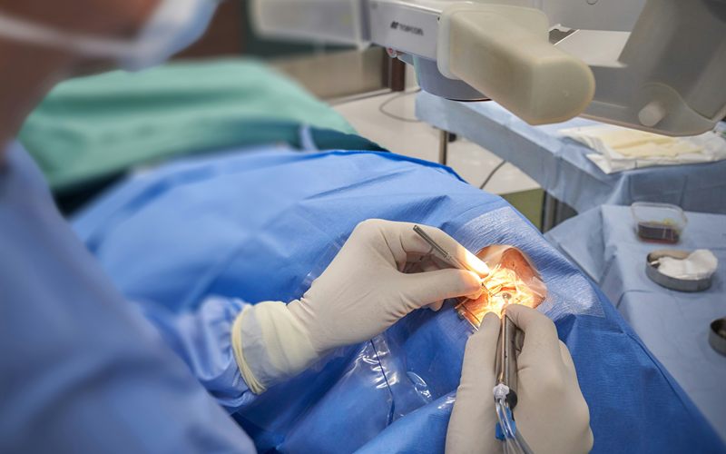 Cirurgia oftalmológica sob microscópio cirúrgico